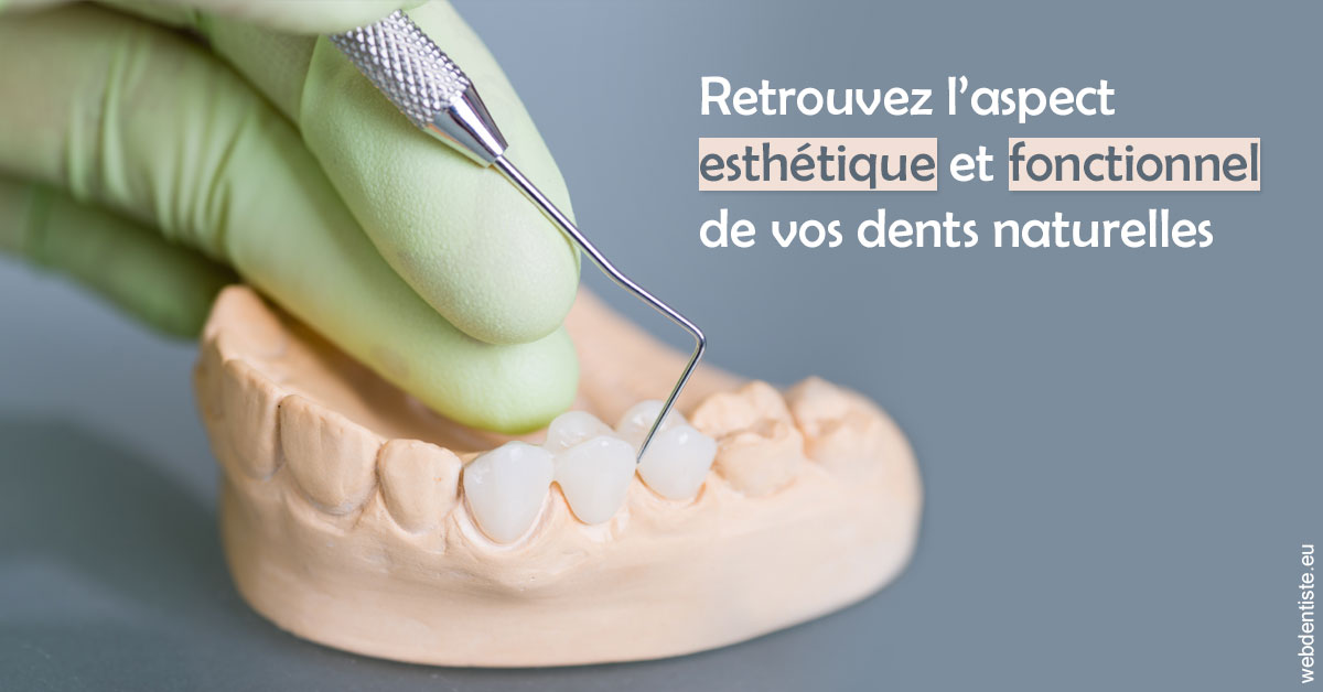 https://dr-benjamin-simonnet.chirurgiens-dentistes.fr/Restaurations dentaires 1