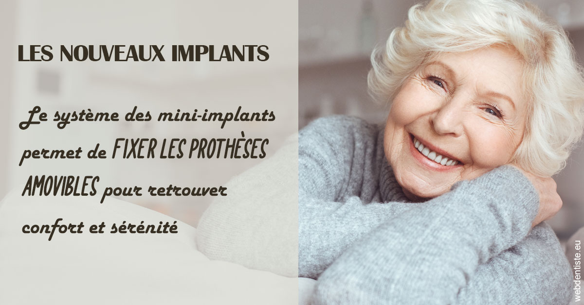 https://dr-benjamin-simonnet.chirurgiens-dentistes.fr/Les nouveaux implants 1