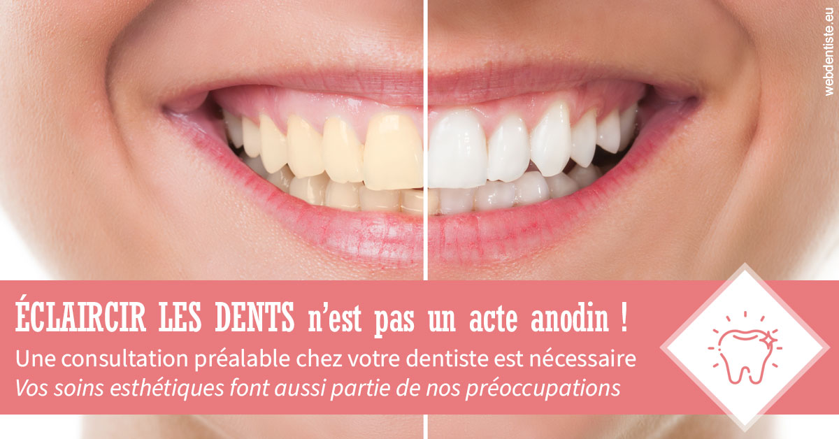 https://dr-benjamin-simonnet.chirurgiens-dentistes.fr/Eclaircir les dents 1