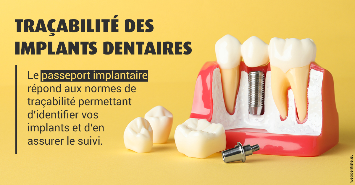 https://dr-benjamin-simonnet.chirurgiens-dentistes.fr/T2 2023 - Traçabilité des implants 2