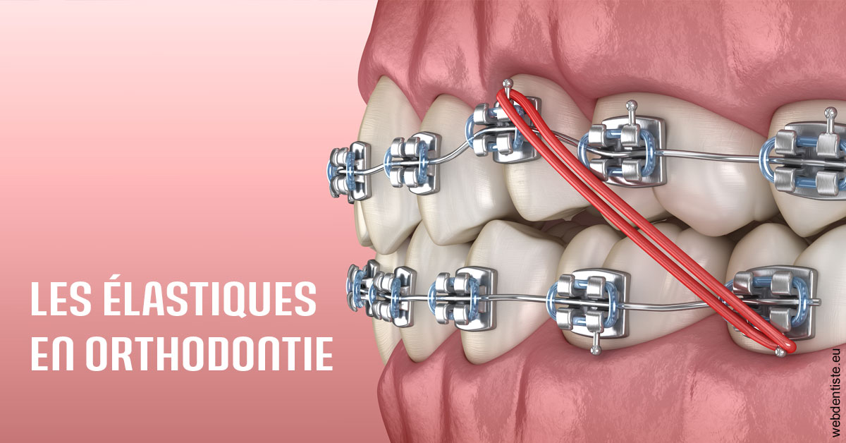 https://dr-benjamin-simonnet.chirurgiens-dentistes.fr/Elastiques orthodontie 2